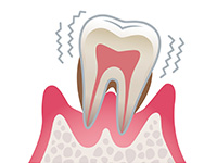 歯周病のカウンセリング イメージ画像